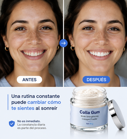 Restaura tu salud oral con CollaGum